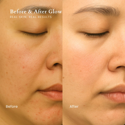 Rose Series Face Mask